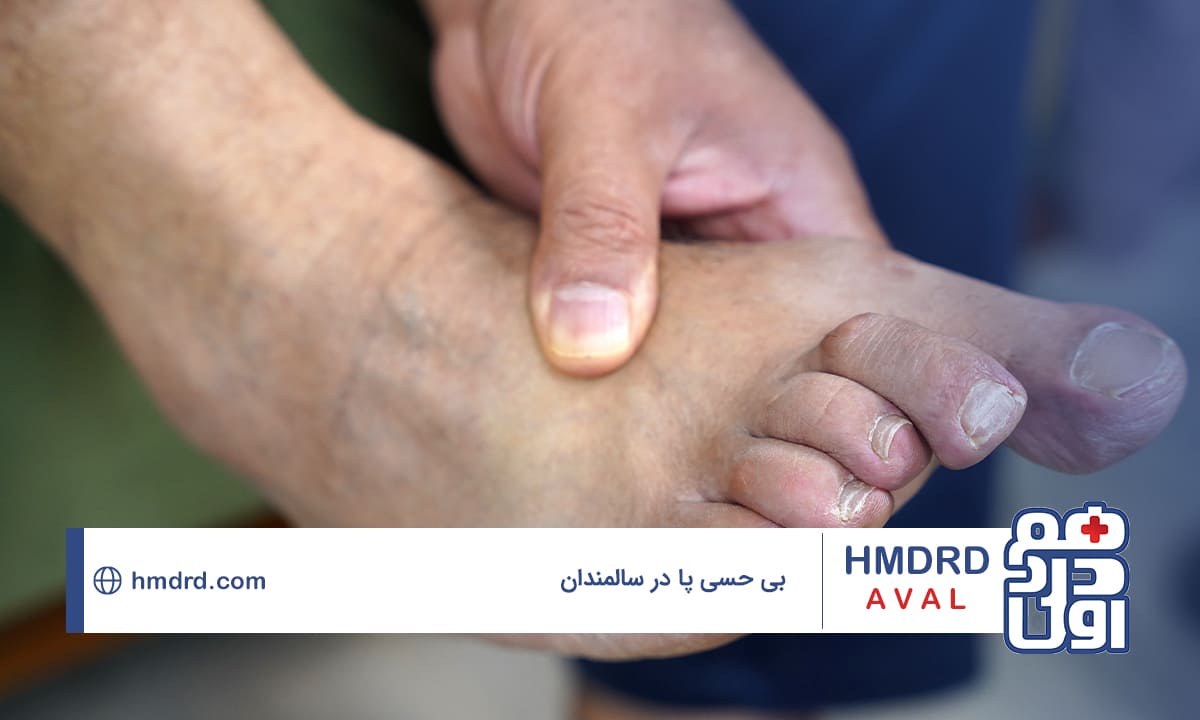 بررسی علل بی حسی پا در سالمندان