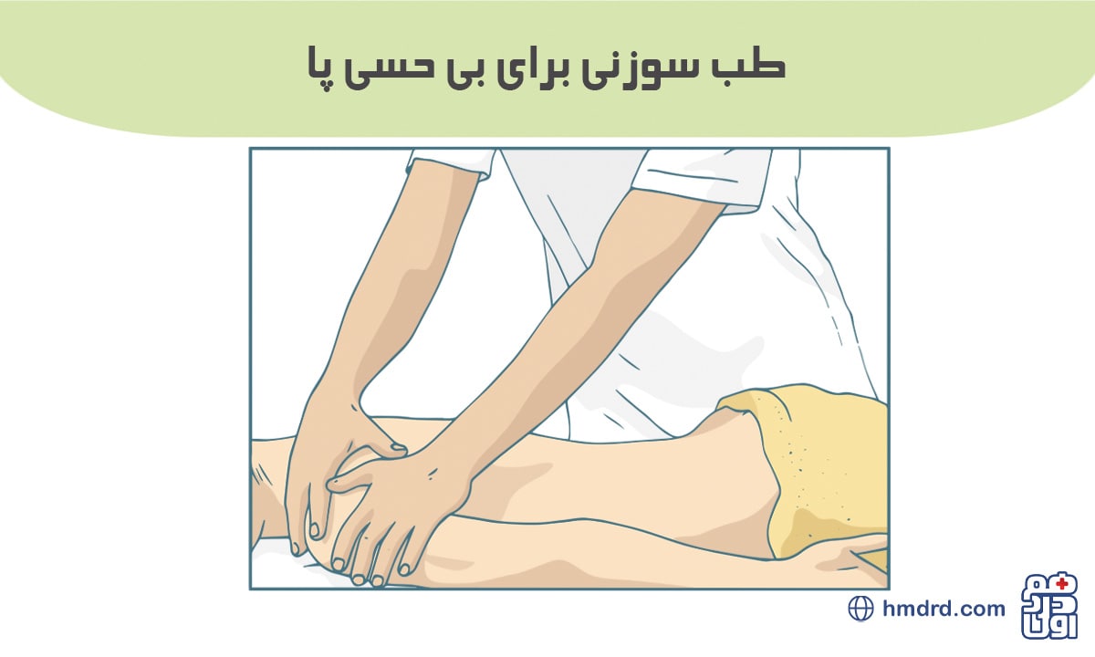 آنچه باید درباره طب سوزنی برای بی حسی پا بدانید