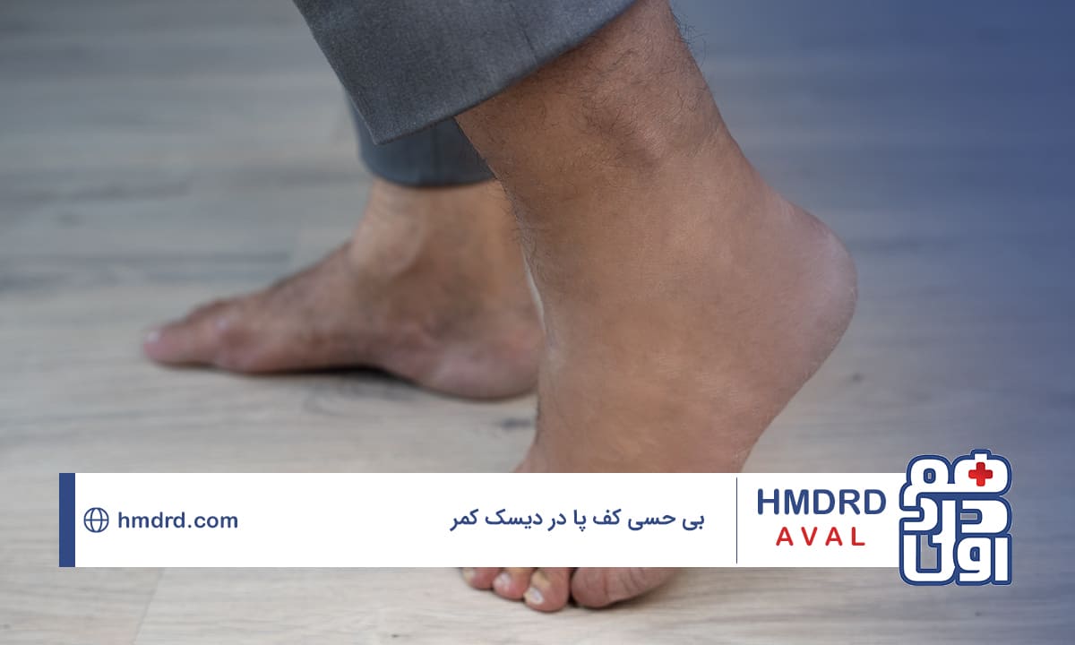 هر چیزی که نیاز است درباره بی حسی کف پا در دیسک کمر بدانید