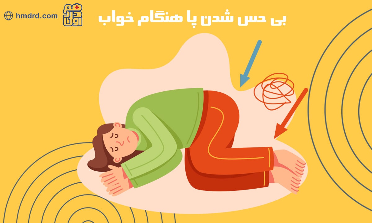 راهکارهایی برای جلوگیری از بی حس شدن پا هنگام خواب