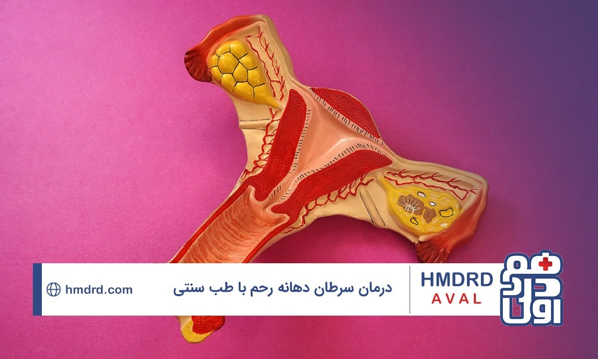 درمان سرطان دهانه رحم با طب سنتی