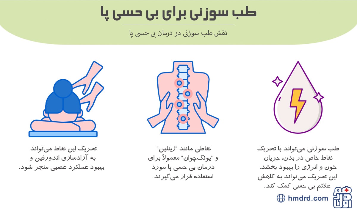 آنچه باید درباره طب سوزنی برای بی حسی پا بدانید