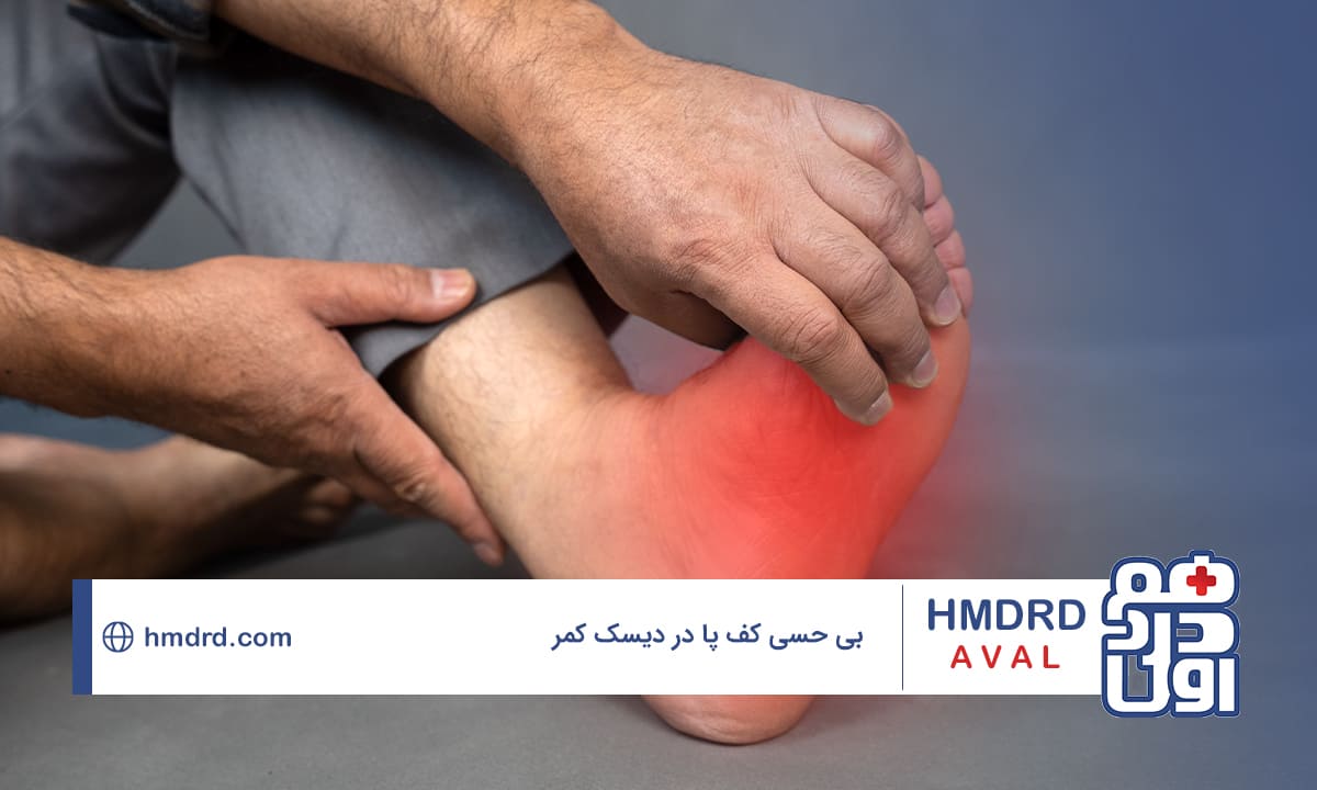 هر چیزی که نیاز است درباره بی حسی کف پا در دیسک کمر بدانید