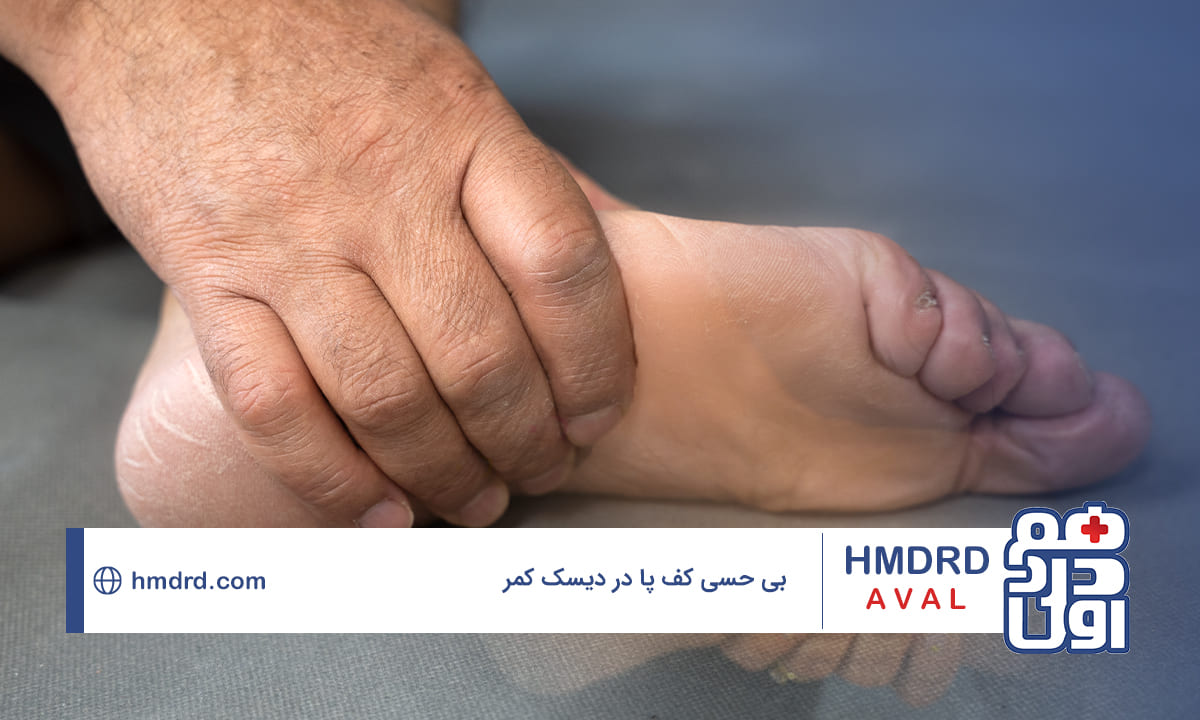 هر چیزی که نیاز است درباره بی حسی کف پا در دیسک کمر بدانید