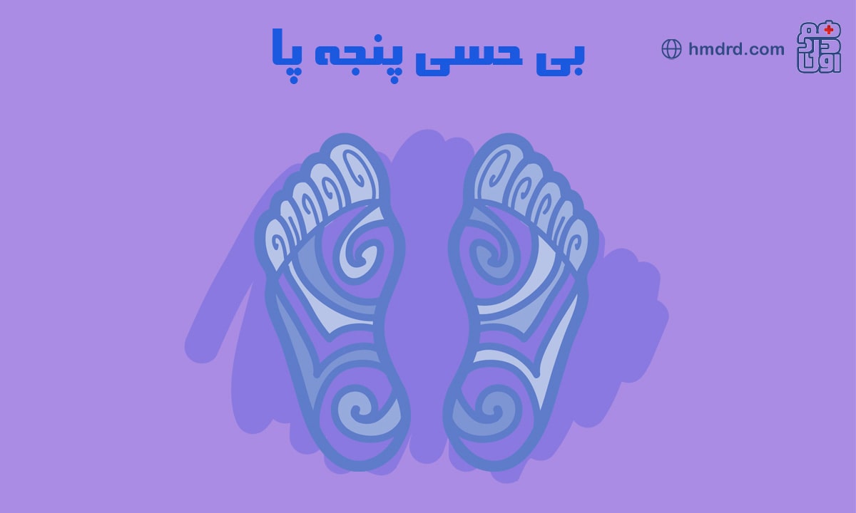 بررسی علت‌ها و عوامل بی‌حسی پنجه پا