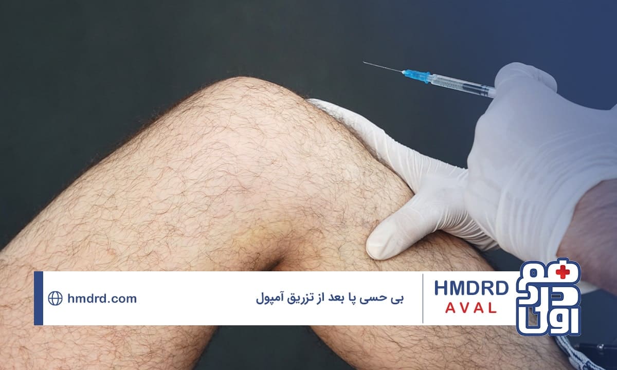 بی حسی پا بعد از تزریق امپول