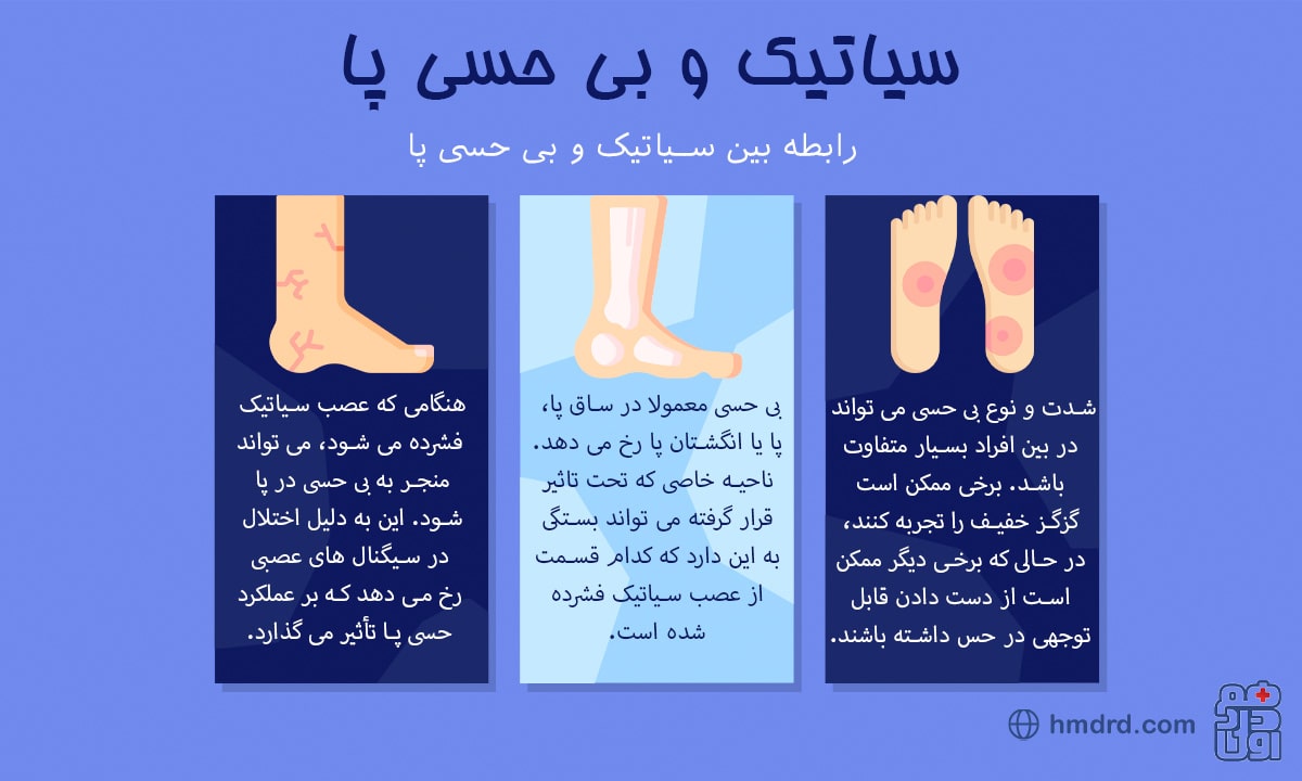 راهنمای جامع برای درک و درمان سیاتیک و بی حسی پا