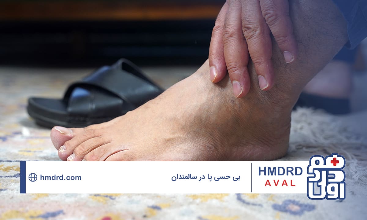بررسی علل بی حسی پا در سالمندان