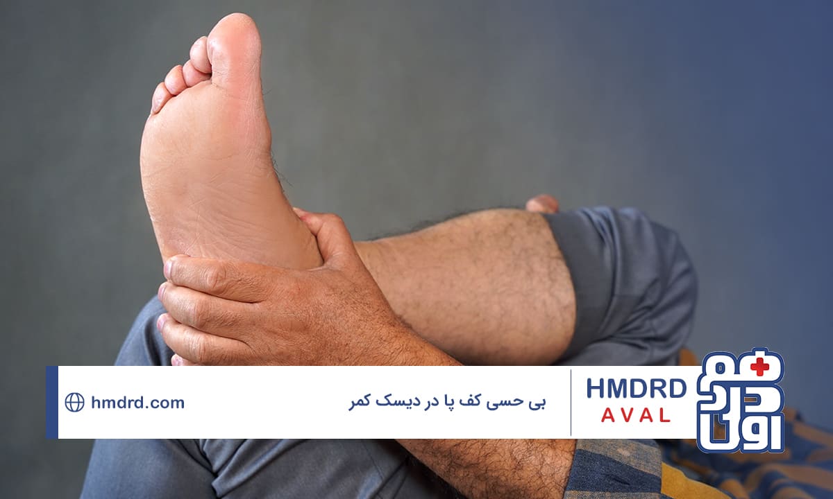 هر چیزی که نیاز است درباره بی حسی کف پا در دیسک کمر بدانید