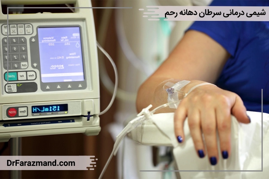 سرطان رحم نیاز به شیمی درمانی دارد
