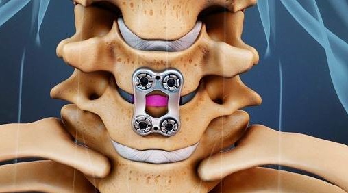 برای درد گردن و شانه به چه دکتری مراجعه کنیم